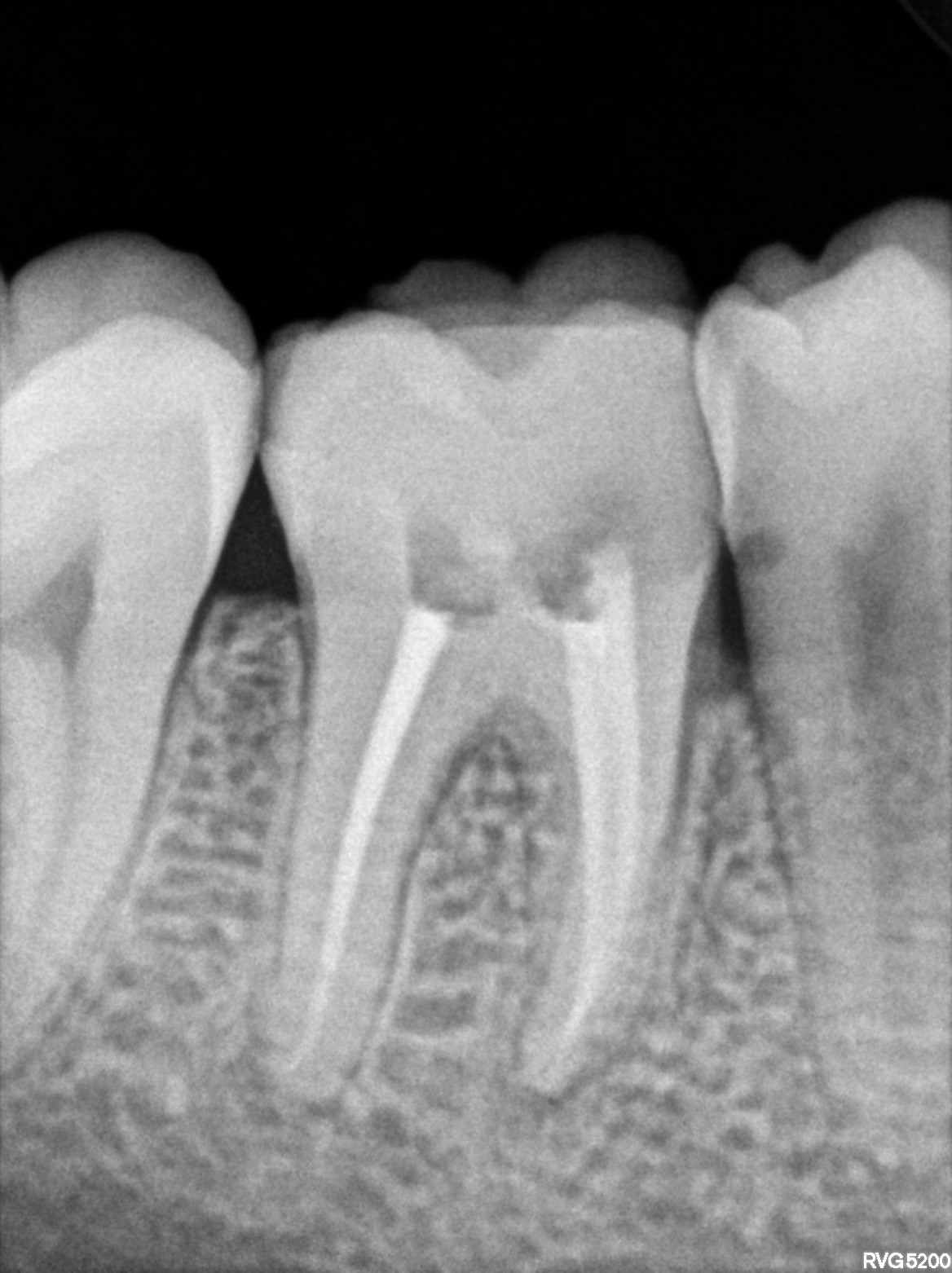 Dental X-ray